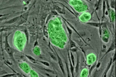 639_cientificos-japoneses-investigan-posibles-tratamientos-con-celulas-madre-en-la-ela.jpg