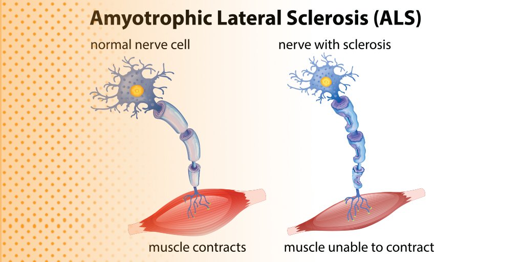 Motoneurona Motoneurona