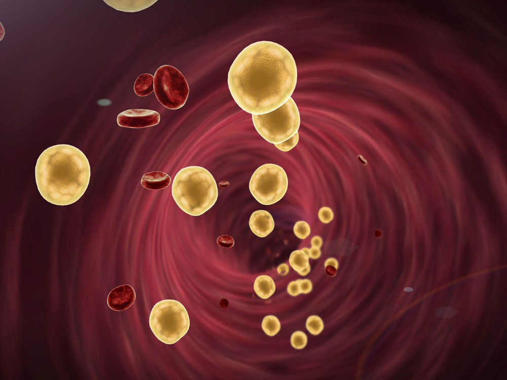 lipoproteínas lipoproteínas
