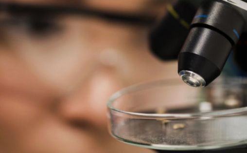 microscopio microscopio