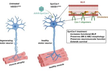 Motoneurona Motoneurona